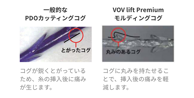 一般的なPDOカッティングコグとVOV lift Premiumモルディングコグの比較